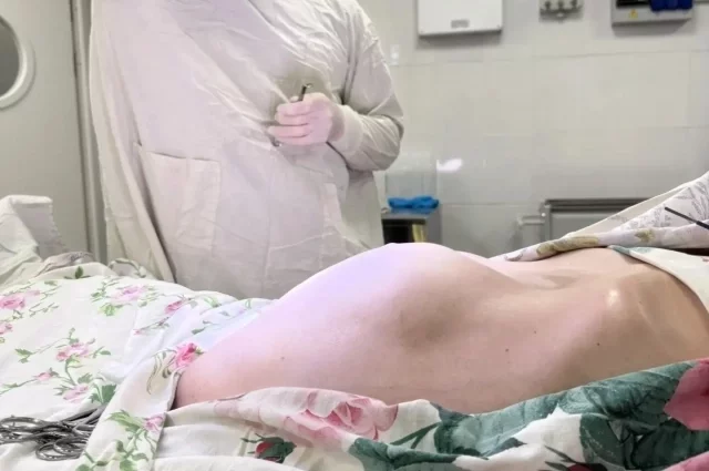 На животе видно, как выпирает опухоль.