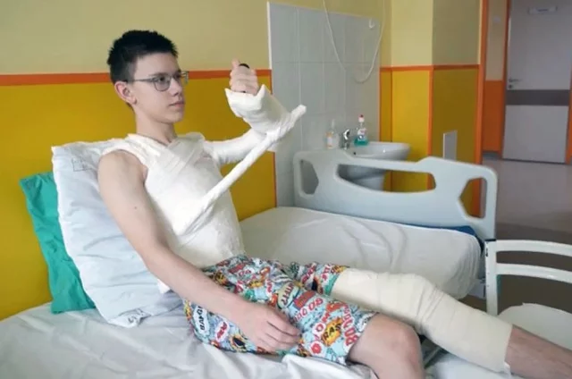 На место неработающей мышцы левой руки хирурги пересадили Денису мышцы со спины и ноги. Благодаря этому конечность начала немного двигаться.