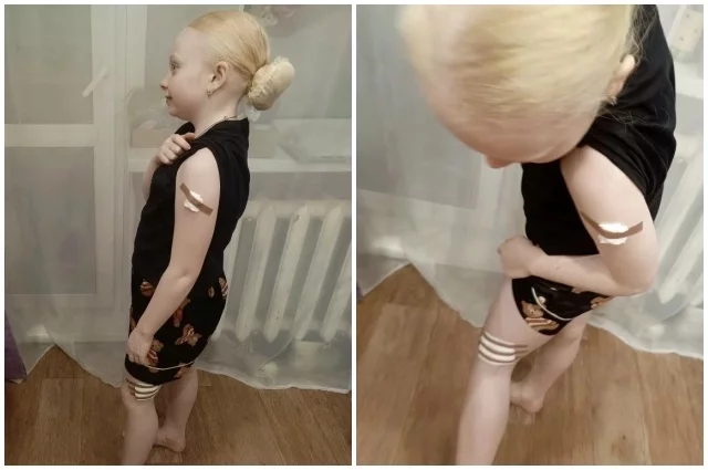 После укусов собаки Арина вынуждена лечиться от бешенства