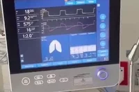 Волгоградец остается в госпитале в тяжелом состоянии