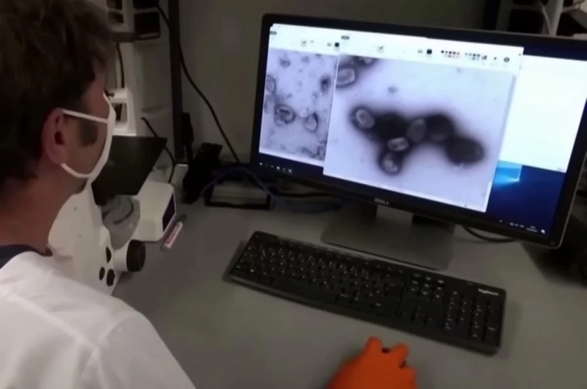 В Подмосковье госпитализирован еще один пациент с оспой обезьян