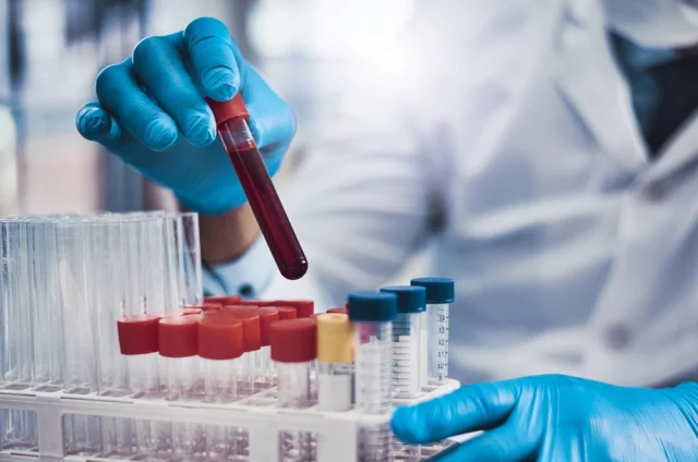 Повышение уровня pTau217 в крови может хорошо предсказывать быстрое развитие симптомов болезни Альцгеймера.