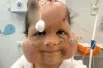 Они должны были постепенно надуваться, растягивая необходимую для перекрытия рубцов кожу. 